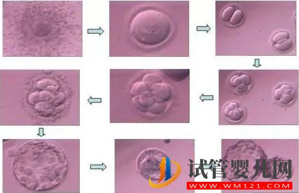胚胎碎片率的变化对试管婴儿意味着什么
