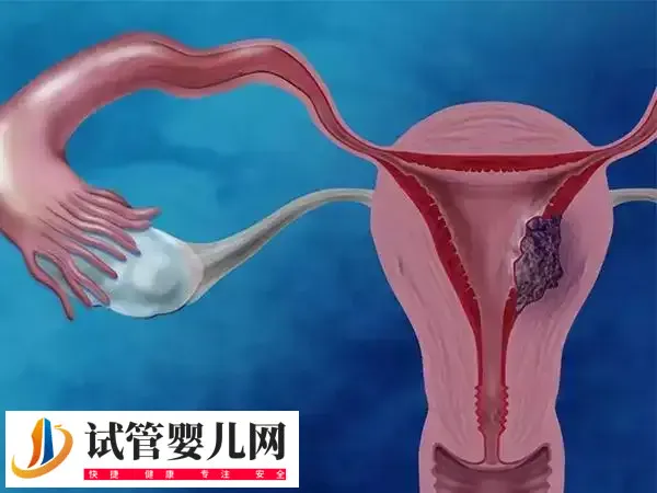 子宫内膜厚对女性的伤害有哪些(图1)