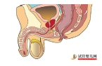 男性性功能障碍怎么得的 男性性功能障碍治疗的七